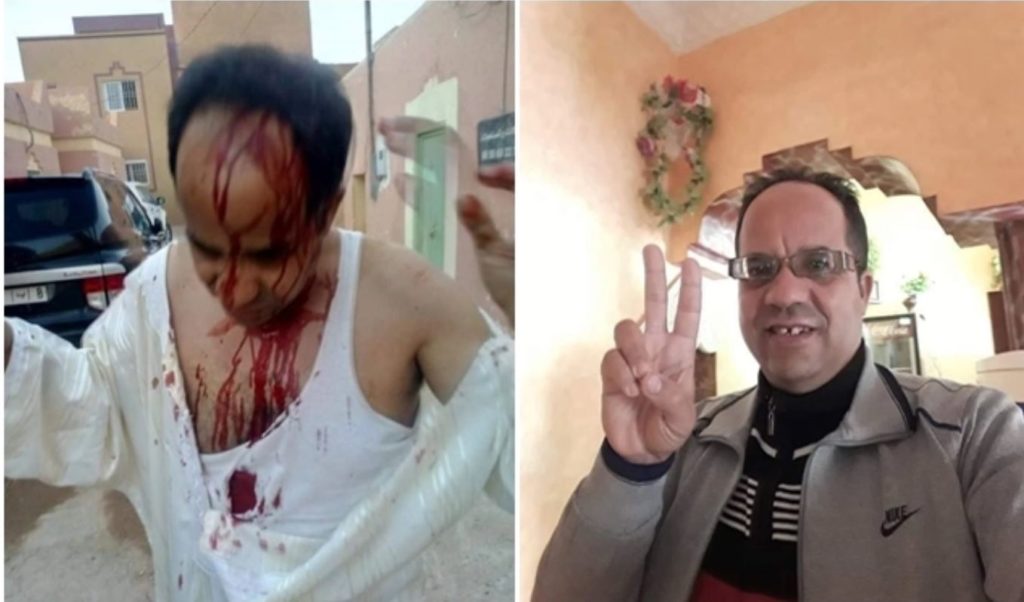 وفاة  المناضل الحقوقي حسن الطاهري بالرشيدية  إثر اعتداء من طرف مجهولين
